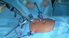 Who should not have epidural anesthesia Why is epidural anesthesia dangerous during surgery?