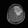 MRI lastele: kuidas ja mis eesmärgil seda tehakse