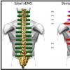 Tips for improving muscle symmetry, pinched nerves and spinal problems