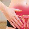 Rjav izcedek pred in po menstruaciji: glavni vzroki Rjav izcedek pred menstruacijo