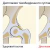 Conservative therapy or surgery: treatment of coxarthrosis of the hip joint Coxarthrosis ICD code 10 in adults