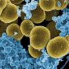 The danger posed to humans by microbial toxins