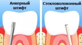 Tooth extension - various methods and their cost