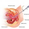 Brown discharge after hysteroscopy IVF after hysteroscopy