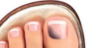 Why is the toenail blackened and sore?
